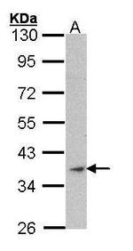 Skeletal Muscle Actin Antibody in Western Blot (WB)