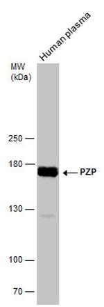 PZP Antibody in Western Blot (WB)