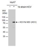 Hepatitis C Virus NS3 Antibody in Western Blot (WB)