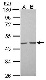 Actin, alpha skeletal muscle Antibody in Western Blot (WB)