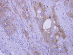 COL4A3BP Antibody in Immunohistochemistry (Paraffin) (IHC (P))