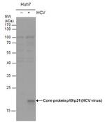 Hepatitis C Virus Core Antigen Antibody in Western Blot (WB)