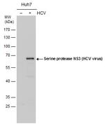 Hepatitis C Virus NS3 Antibody in Western Blot (WB)