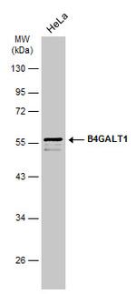 B4GALT1 Antibody in Western Blot (WB)