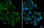 GALNT3 Antibody in Immunocytochemistry (ICC/IF)