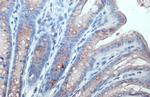 GALNT3 Antibody in Immunohistochemistry (Paraffin) (IHC (P))