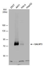 GALNT3 Antibody in Western Blot (WB)