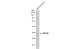 NPHS2 Antibody in Western Blot (WB)