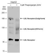 LDL receptor Antibody in Western Blot (WB)