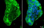 ABCA1 Antibody in Immunocytochemistry (ICC/IF)