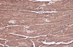 C3G Antibody in Immunohistochemistry (Paraffin) (IHC (P))