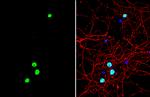 FOXG1 Antibody in Immunocytochemistry (ICC/IF)