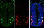 LHX3 Antibody in Immunohistochemistry (Paraffin) (IHC (P))