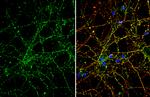 Robo2 Antibody in Immunocytochemistry (ICC/IF)