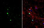 BCL11B Antibody in Immunocytochemistry (ICC/IF)