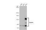 Palladin Antibody in Western Blot (WB)