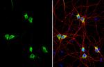 Synapsin II Antibody in Immunocytochemistry (ICC/IF)