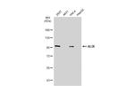 Alix Antibody in Western Blot (WB)