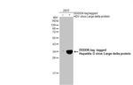 Hepatitis D Virus Large delta Protein Antibody in Western Blot (WB)