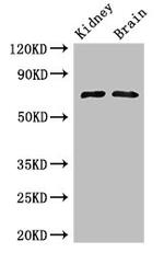 GAA Antibody in Western Blot (WB)