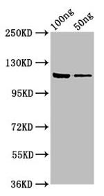 E. coli GLB1 Antibody in Western Blot (WB)