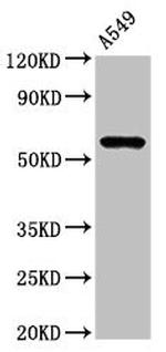 IL1R1 Antibody in Western Blot (WB)