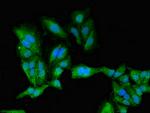 PKA beta Antibody in Immunocytochemistry (ICC/IF)