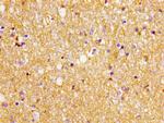 GLT-1 Antibody in Immunohistochemistry (Paraffin) (IHC (P))