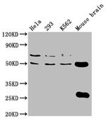 TUBB4A Antibody in Western Blot (WB)