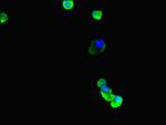 TUBB4A Antibody in Immunocytochemistry (ICC/IF)