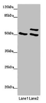 TUBB4A Antibody in Western Blot (WB)