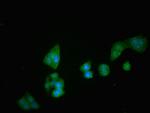 CD26 Antibody in Immunocytochemistry (ICC/IF)