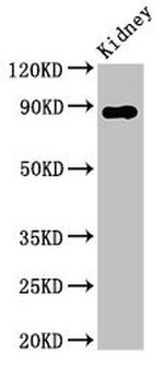 CD26 Antibody in Western Blot (WB)