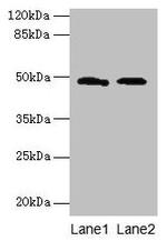 E. coli SurA Antibody in Western Blot (WB)