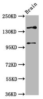 SOS1 Antibody in Western Blot (WB)