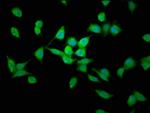 LAPTM4B Antibody in Immunocytochemistry (ICC/IF)