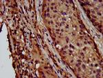 LAPTM4B Antibody in Immunohistochemistry (Paraffin) (IHC (P))