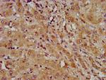 LAPTM4B Antibody in Immunohistochemistry (Paraffin) (IHC (P))