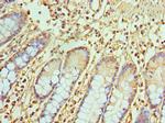 TREX1 Antibody in Immunohistochemistry (Paraffin) (IHC (P))