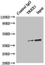 TREX1 Antibody in Immunoprecipitation (IP)