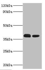 TREX1 Antibody in Western Blot (WB)