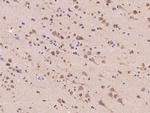 ACOT1 Antibody in Immunohistochemistry (Paraffin) (IHC (P))