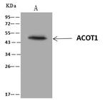 ACOT1 Antibody in Immunoprecipitation (IP)