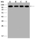 alpha Actinin 4 Antibody in Western Blot (WB)