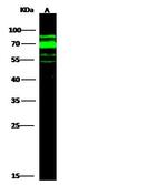 AFP Antibody in Western Blot (WB)