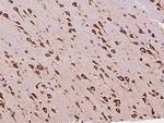 EMAP II Antibody in Immunohistochemistry (Paraffin) (IHC (P))