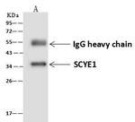 EMAP II Antibody in Immunoprecipitation (IP)