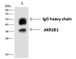 AKR1B1 Antibody in Immunoprecipitation (IP)