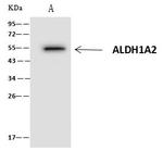 ALDH1A2 Antibody in Immunoprecipitation (IP)