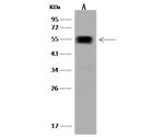 ALDH1A2 Antibody in Western Blot (WB)